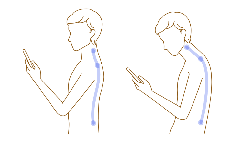 スマホ首とストレートネック