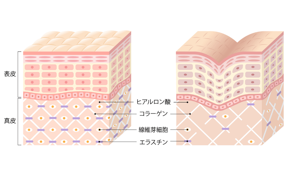 肌のコラーゲンとエラスチン