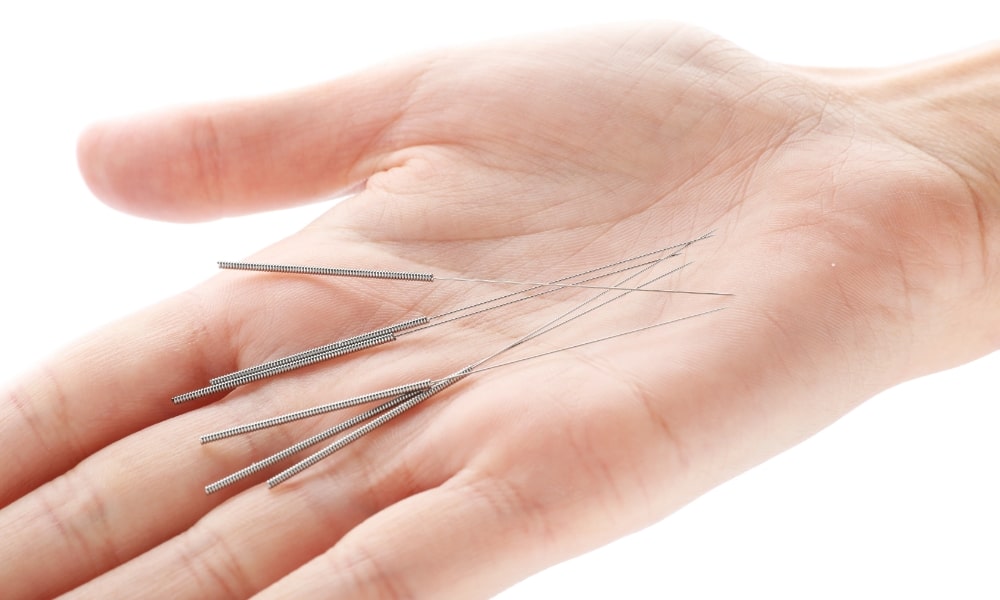 鍼灸で使う鍼
