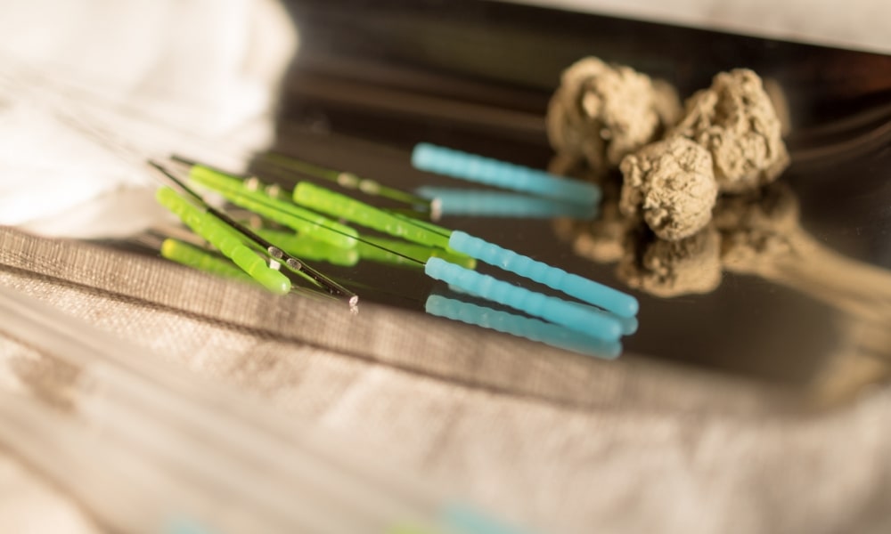 鍼灸で使う鍼と艾